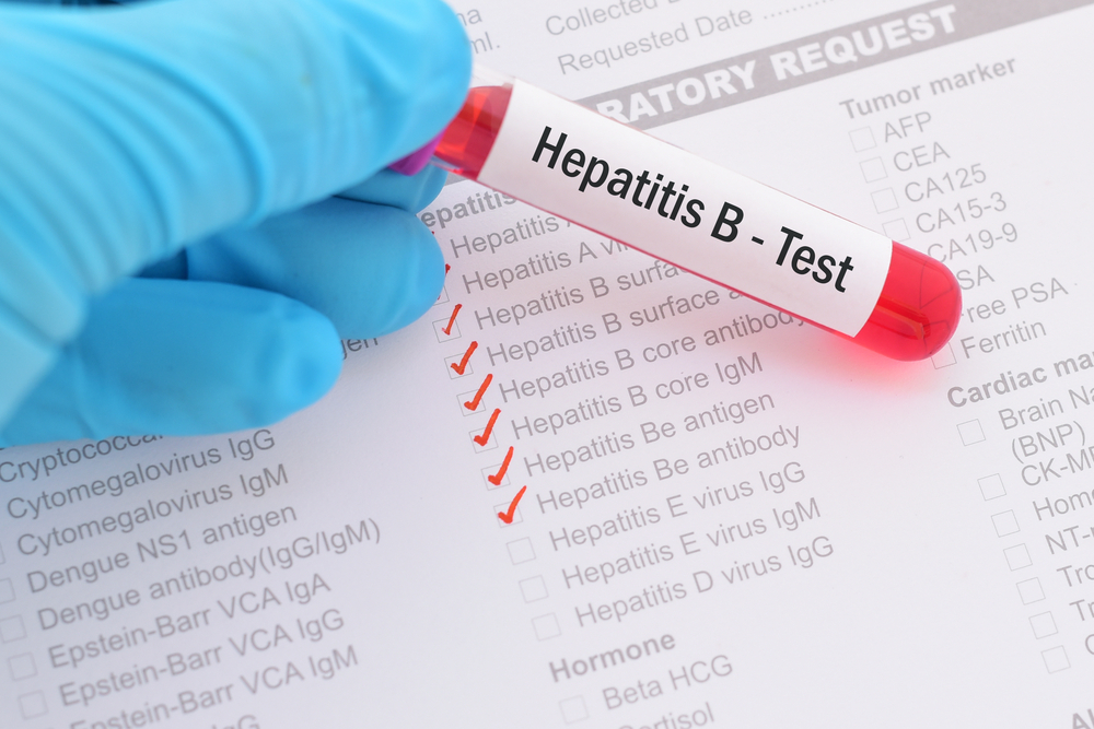 Frasco de teste de hepatite B e folha com sintomas