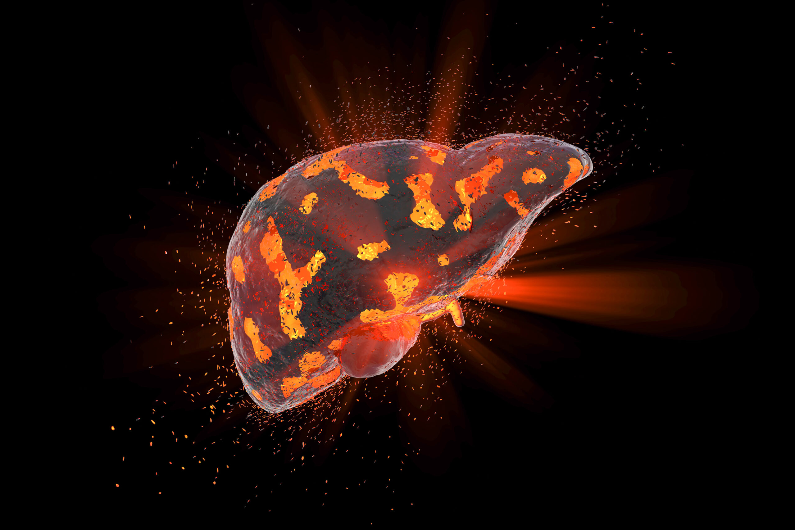 Imagem de um fígado