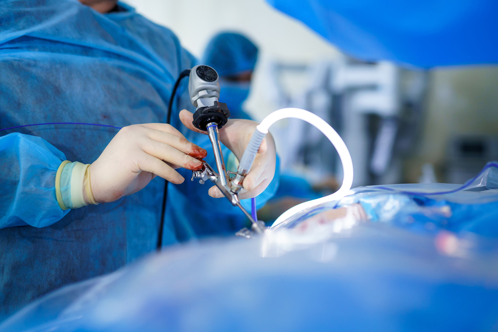 Médico colocando tubo na realização de cirurgia bariátrica